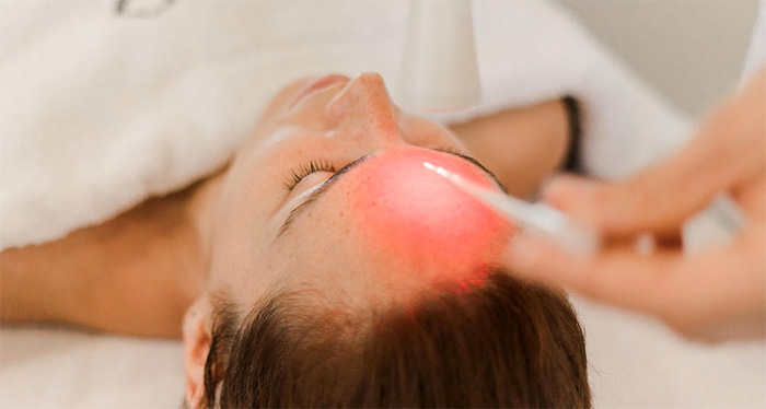 ELECTROPORACION ESTETICA