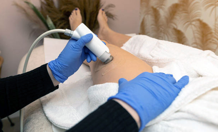 ELECTROPORACION ESTETICA