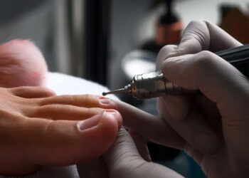 MESOTERAPIA SIN AGUJAS EN LOS PIES