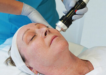 RADIOFRECUENCIA FRACCIONADA