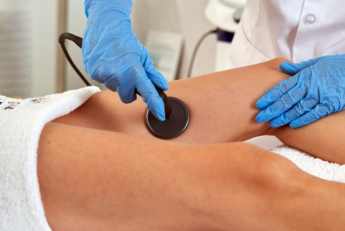 RADIOFRECUENCIA EN ESTETICA