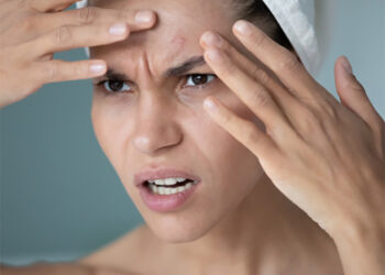 Renovación y desintoxicación de la piel con stress