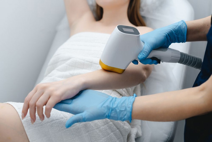 SHR: Tecnología Super Hair Removal