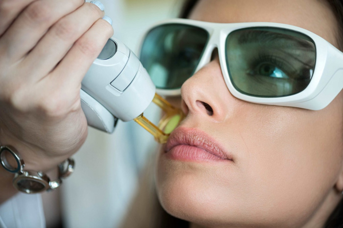 SHR: Tecnología Super Hair Removal