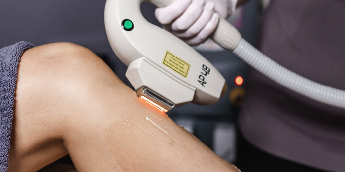 SHR: Tecnología Super Hair Removal