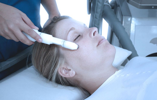 MICRODERMOABRASION