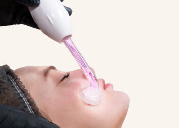 Radiofrecuencia facial: un enfoque no invasivo para el rejuvenecimiento cutáneo