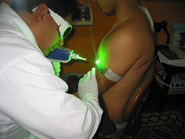 Eliminación de tatuajes con láser