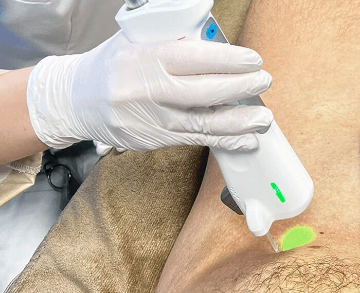 cavado profundo masculino