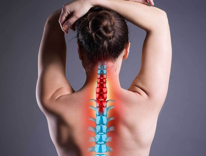 Síndrome de Dolor Miofascial y puntos gatillo