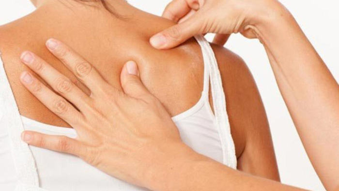 Síndrome de Dolor Miofascial y puntos gatillo