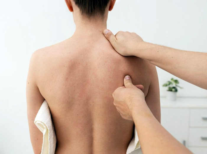 Síndrome de Dolor Miofascial y puntos gatillo