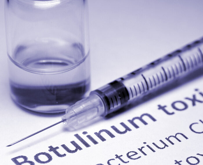 TOXINA BOTULINICA