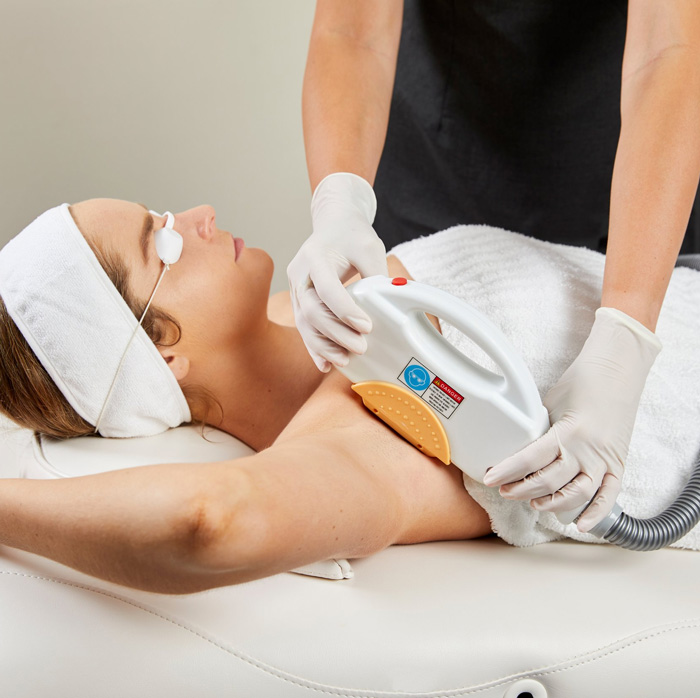 Depilación IPL: ventajas y desventajas de la luz pulsada intensa