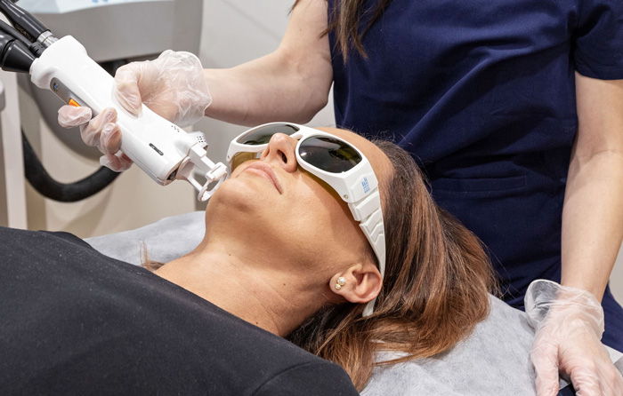 Depilación definitiva de rostro