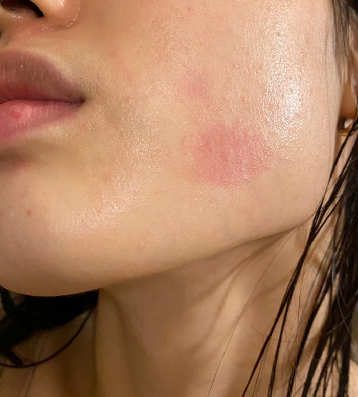 Maquillaje y dermatitis