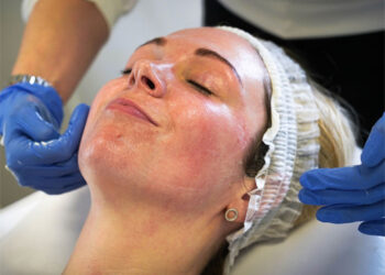 Nieve carbónica: un recurso innovador y muy profesional