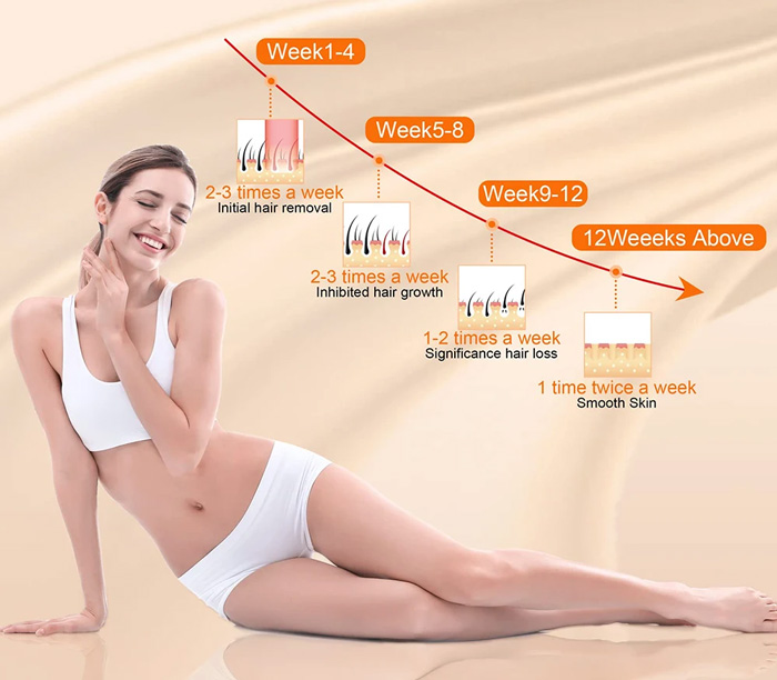 Fotodepilación: elección y planificación del tipo de tratamiento más adecuado