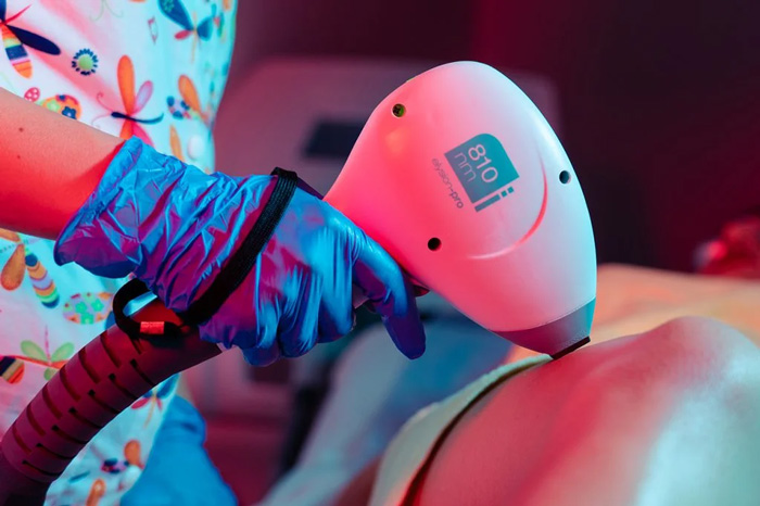 Fotodepilación: elección y planificación del tipo de tratamiento más adecuado