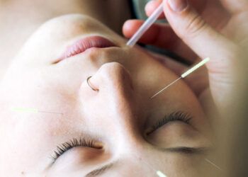 ACUPUNTURA COSMETICA