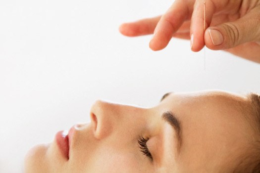 ACUPUNTURA COSMETICA