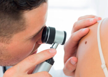 Qué es el cáncer de piel