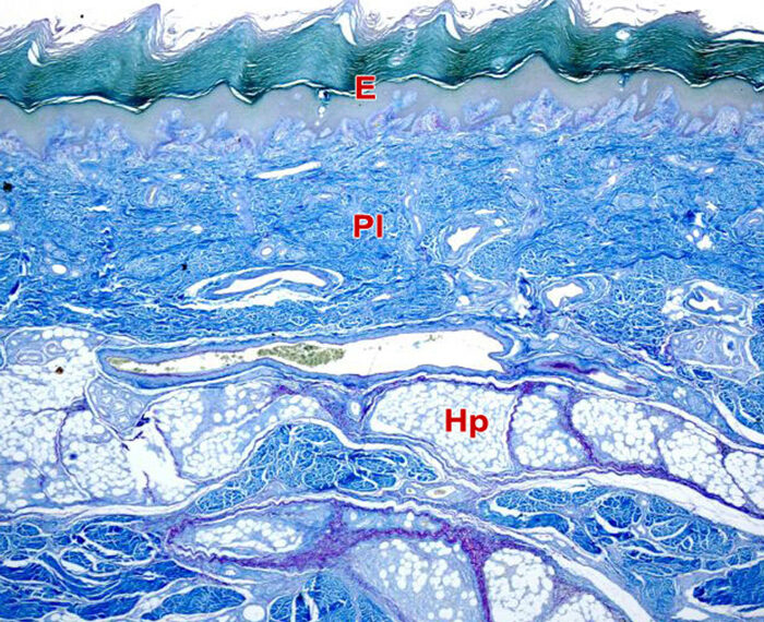 Dermis conjuntiva: estratos papilar y reticular