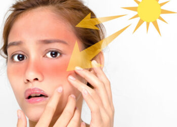 Efectos biológicos de la radiación UV sobre la piel