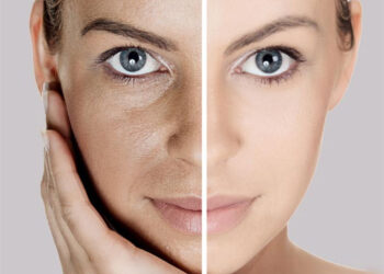 Afipore Cream reduce poros dilatados