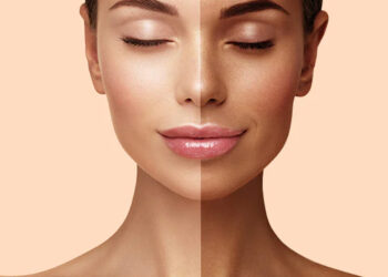 Protocolo: acelerador del bronceado