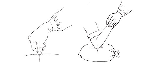 Técnicas del masaje Tui Na