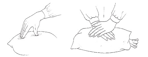 Técnicas del masaje Tui Na