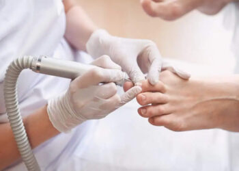 Descamación, estrías, micosis... las diferentes afecciones de las uñas