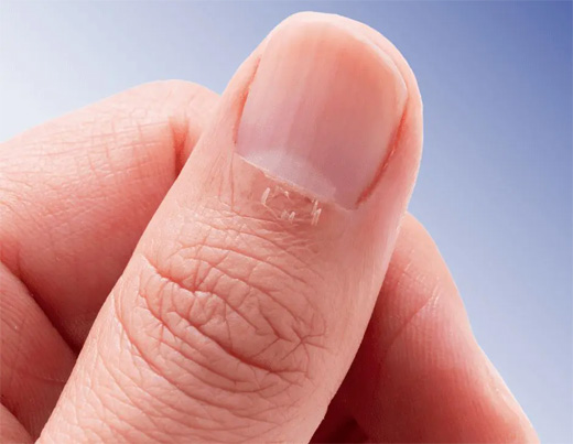 UÑAS Y PIEL
