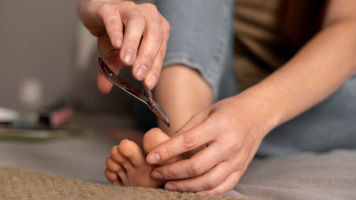 11 problemas habituales de las uñas