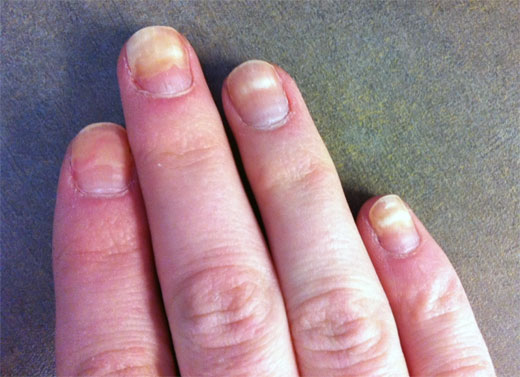 Uñas: siete signos reveladores de trastornos en la salud