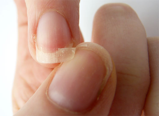 Uñas: siete signos reveladores de trastornos en la salud