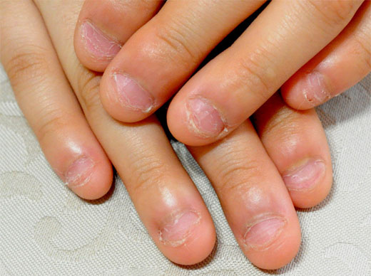 Uñas: siete signos reveladores de trastornos en la salud