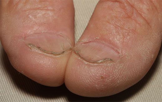 Uñas: siete signos reveladores de trastornos en la salud